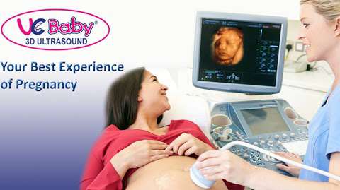 UC Baby 3D Ultrasound